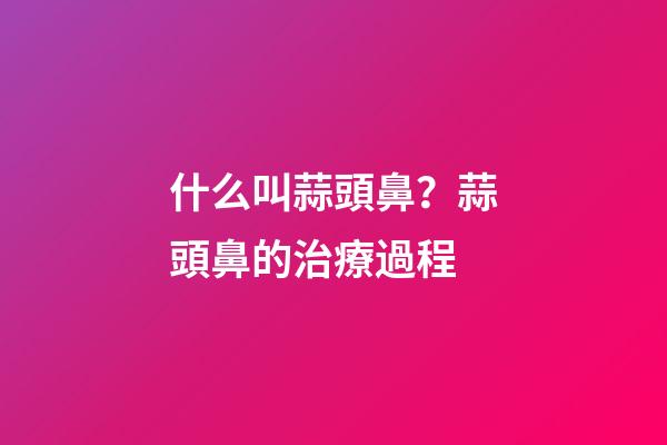 什么叫蒜頭鼻？蒜頭鼻的治療過程