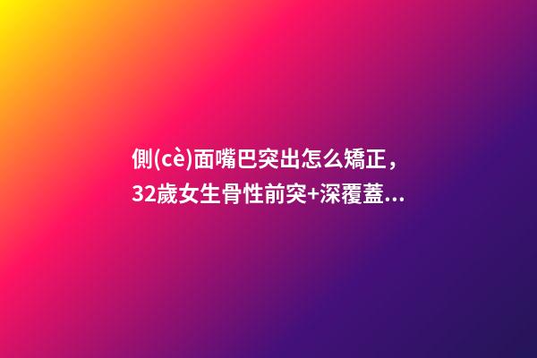 側(cè)面嘴巴突出怎么矯正，32歲女生骨性前突+深覆蓋Ⅲ度-第1張-觀點-玄機派
