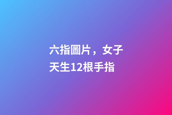 六指圖片，女子天生12根手指