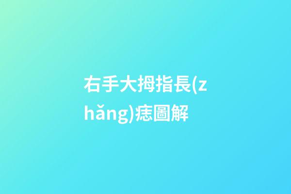 右手大拇指長(zhǎng)痣圖解