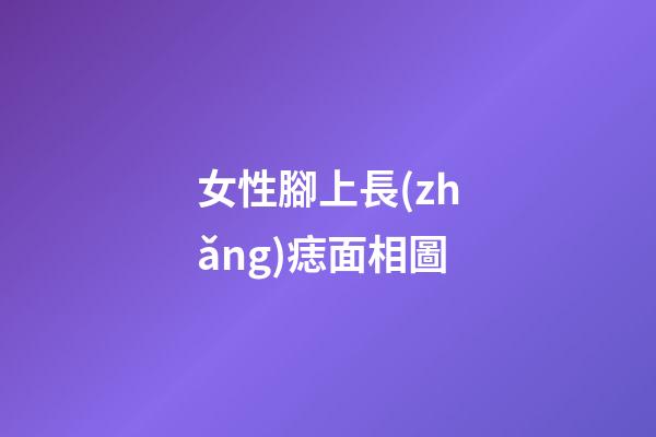 女性腳上長(zhǎng)痣面相圖