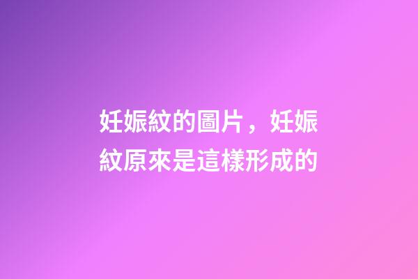 妊娠紋的圖片，妊娠紋原來是這樣形成的-第1張-觀點-玄機派