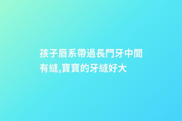 孩子唇系帶過長門牙中間有縫,寶寶的牙縫好大-第1張-觀點(diǎn)-玄機(jī)派