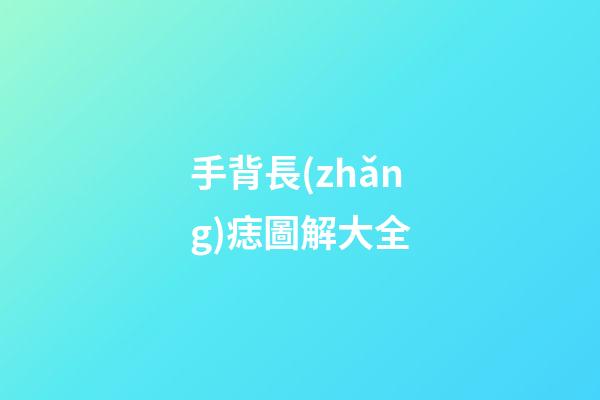 手背長(zhǎng)痣圖解大全