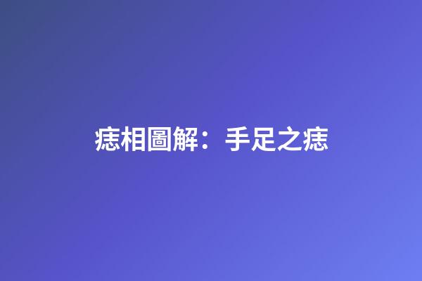 痣相圖解：手足之痣