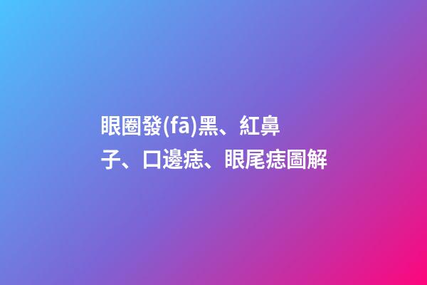 眼圈發(fā)黑、紅鼻子、口邊痣、眼尾痣圖解