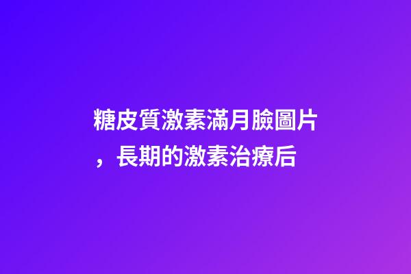 糖皮質激素滿月臉圖片，長期的激素治療后-第1張-觀點-玄機派