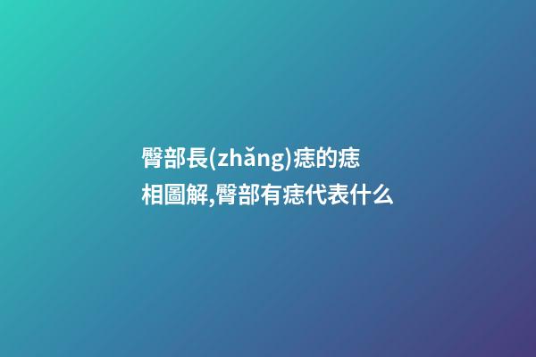 臀部長(zhǎng)痣的痣相圖解,臀部有痣代表什么