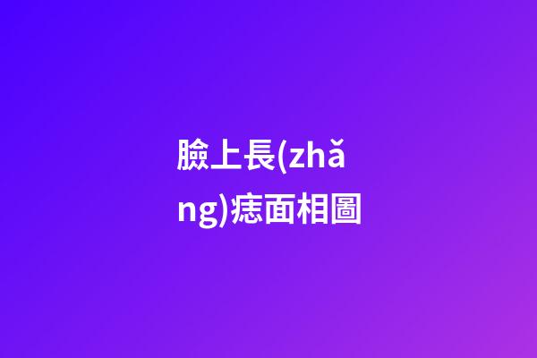 臉上長(zhǎng)痣面相圖（面部痣好壞一覽表）