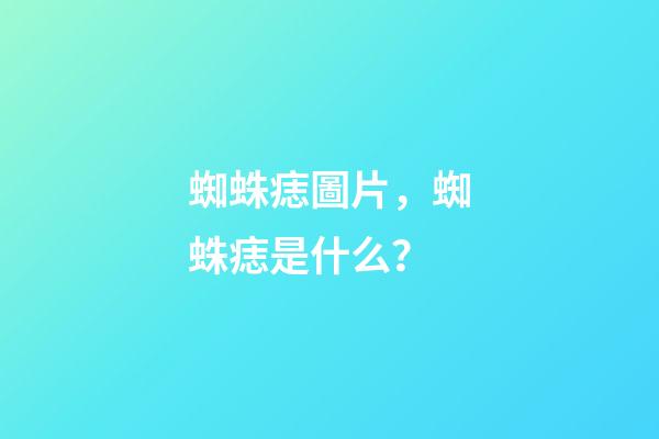 蜘蛛痣圖片，蜘蛛痣是什么？