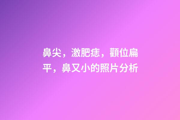 鼻尖，激肥痣，顴位扁平，鼻又小的照片分析